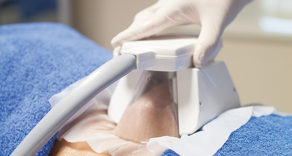 How Fat Freezing and HIFU Work Together? 2 Multiple Areas in One Session HIFU and Fat Freezing Melton Mowbray