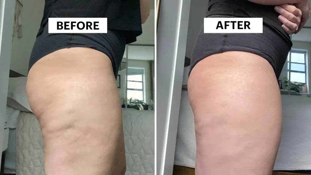 Do Toning Exercise Melton Mowbray Really Tackle Cellulite?