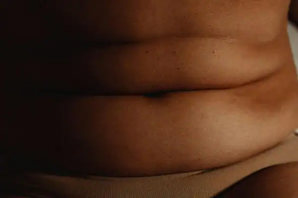 The Hidden Connection: How Stress Shapes Your Fitness and Body Composition 3 image of what stress can do on the stomach area and how Lipo 360 Melton Mowbray can help to change your body shape.